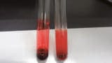 Navigating the Vast Array of Sample Preparation Techniques for Biological Samples – Whole Blood