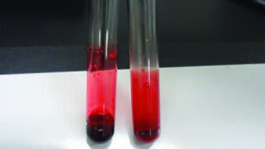 Navigating the Vast Array of Sample Preparation Techniques for Biological Samples – Whole Blood