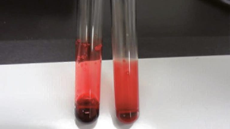 Navigating the Vast Array of Sample Preparation Techniques for Biological Samples – Whole Blood