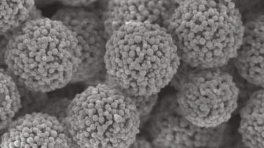 Spheres-on-sphere (SOS) Silica a Real Support for Separation of Large Biomolecules