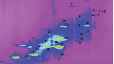 Recent Advances in Two-dimensional Liquid Chromatography