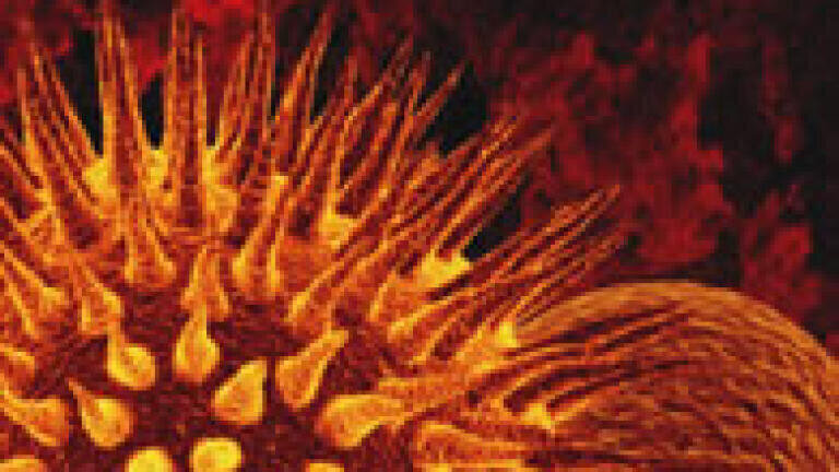 Moving IR Spectroscopy Down to the Micron Level Puts Serial Killer Behind Bars