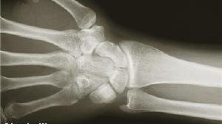Trace elements found in human bones