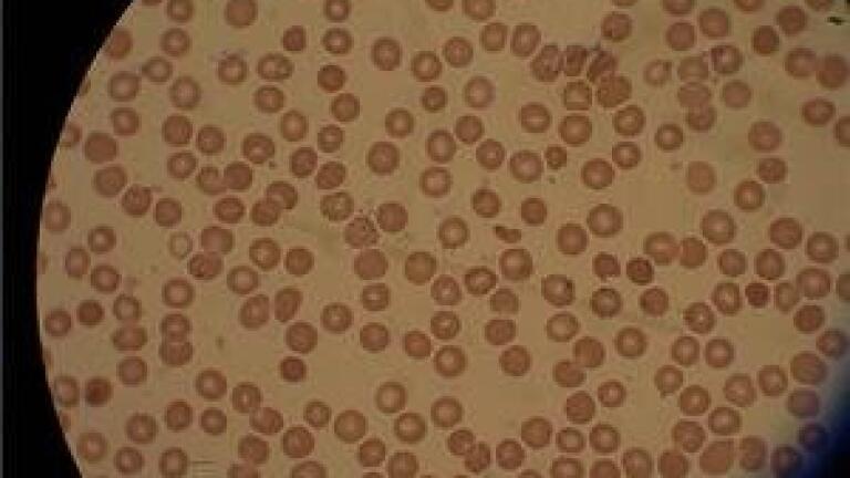 MS reveals location of biologically active substances in malaria parasite
