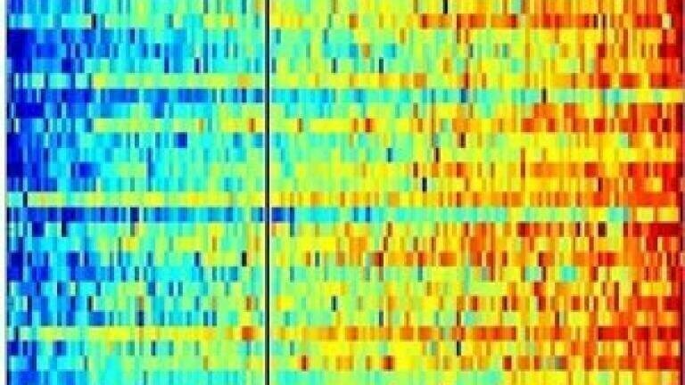 Electrophoretic fluorescence used to seek melanoma biomarkers