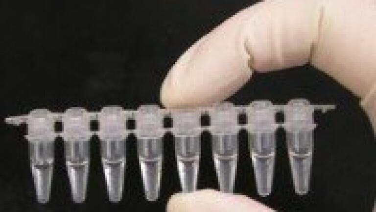 GC-MS helps in identifying metabolomic correlations