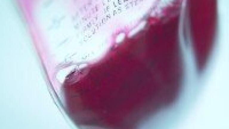 Analytical chemistry reveals HDL-C impact of PCSK9 E670G polymorphism