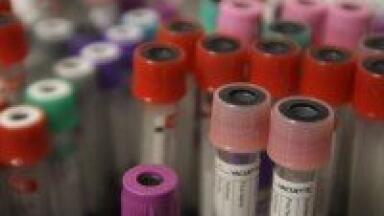Biologically active substances 'differ in hepatitis E patients'