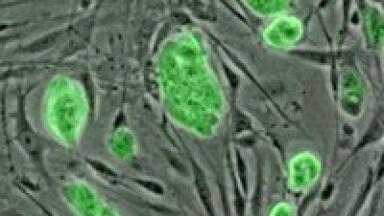 Pharma patents 'are stifling stem cell research'
