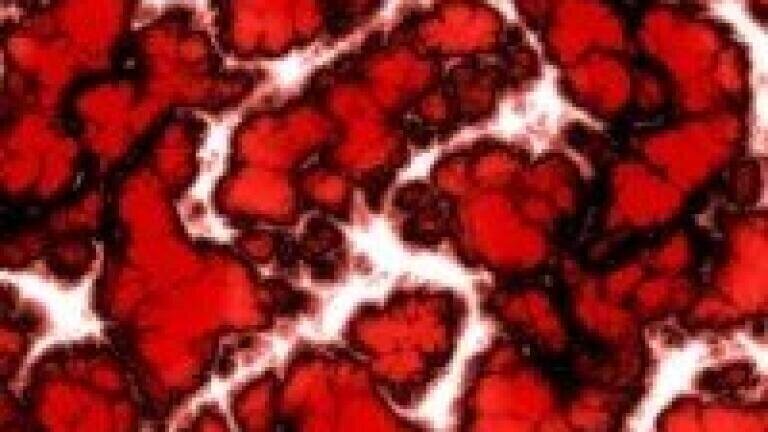Insights into psychotic disorders uncovered by chromatography and spectrometry