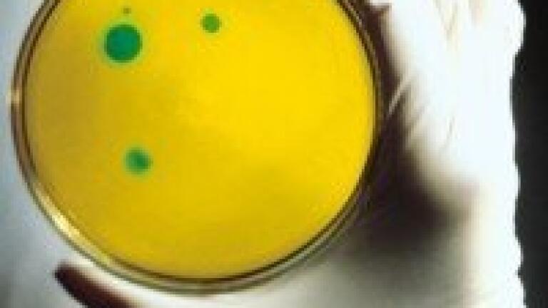 Electrophoresis used to analyse probiotics