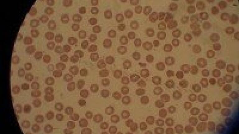 Mass spectrometry: Anti-malarial properties proven in new compound