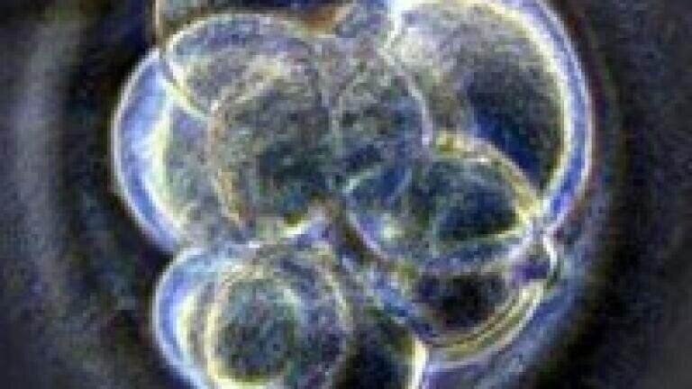 Scientists discover proteins useful to the study of infertility