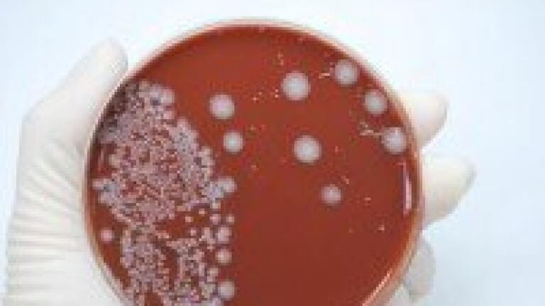 Expression of tung tree DGAT1 in E.coli