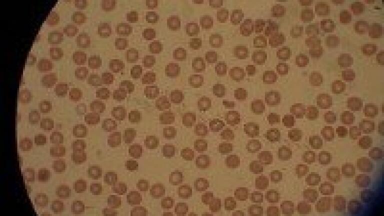 Quantitative analysis used in malaria study