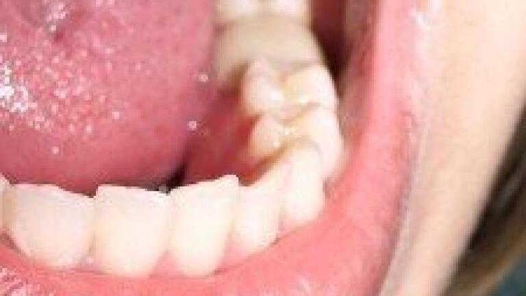 Saliva used to identify disease biomarkers
