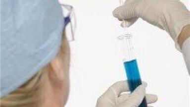 Identification of human colorectal cancer proteins