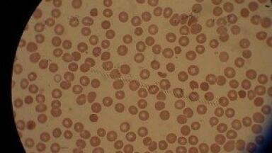Mass spectrometry reveals counterfeit anti malarials in Africa