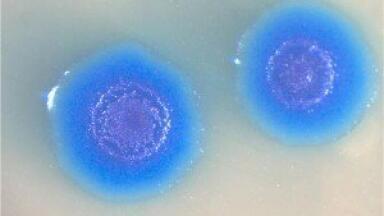 Comet assay and pulsed-field electrophoresis used to detect genome use
