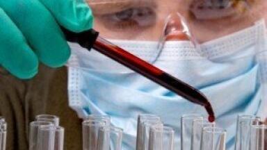 Rapid identification of Staphylococcus aureus in blood cultures developed