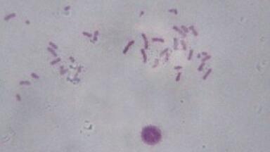 New approach to intra-cellular investigations