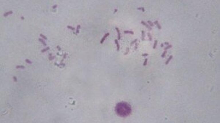 New approach to intra-cellular investigations