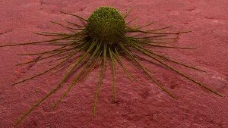Single antibody found to shrink tumors