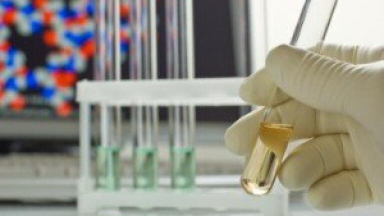 New fluorescence procedure leads to protein complexes in living cells