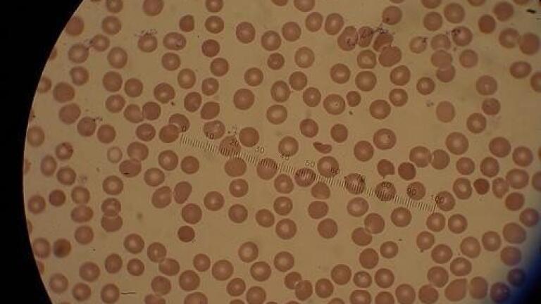Chinese herbal medicine may be used as malaria treatment