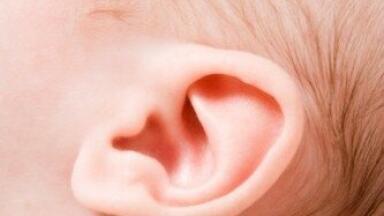 ABI clinical trial aims to help young deaf children to hear