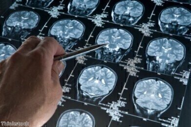 Alzheimer's treatment on horizon following successful lab tests