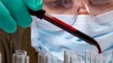 Sepsis screening could hold key to early diagnosis