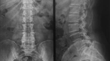 New light shone on nerve regeneration after spinal injury