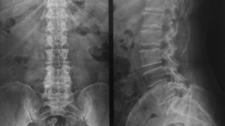 New light shone on nerve regeneration after spinal injury