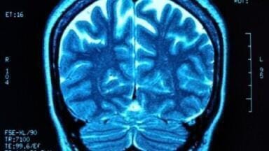 Brain tumour treatment results in 'higher than average' survival rates