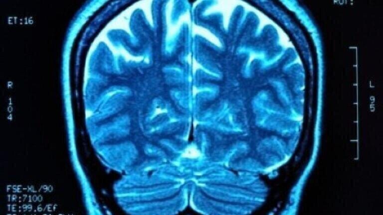 Brain tumour treatment results in 'higher than average' survival rates