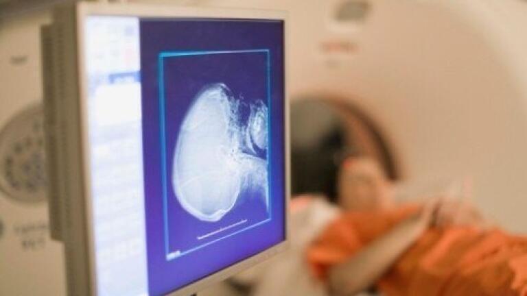 Drug to reactivate immune cells could treat brain cancer