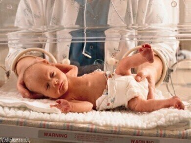 Biomarker could determine developmental issues in premature babies