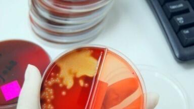 Compounds discovered for treatment of neglected chagas disease