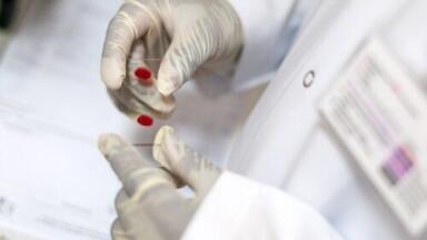 Scientists target new protein for HIV treatment