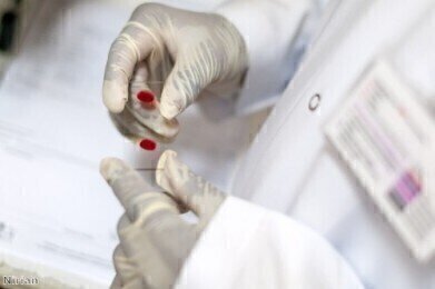 Scientists target new protein for HIV treatment