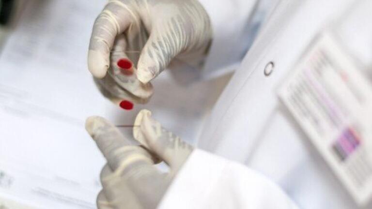 Scientists target new protein for HIV treatment