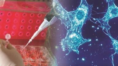Tissue testing could prevent breast cancer reoperation