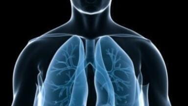Scientists identify lung cancer protein