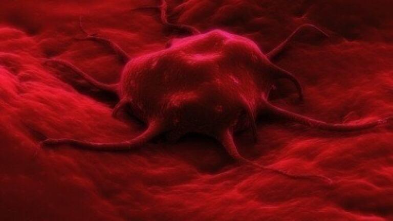 New way to combat skin cancer drug resistance discovered