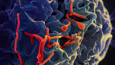 Can Chromatography Help Cure Ebola?