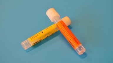 Chromatography Turns Psychologist – Looking Back at the Mauve Spot