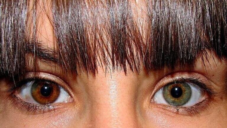 Predicting Eye and Skin Colour