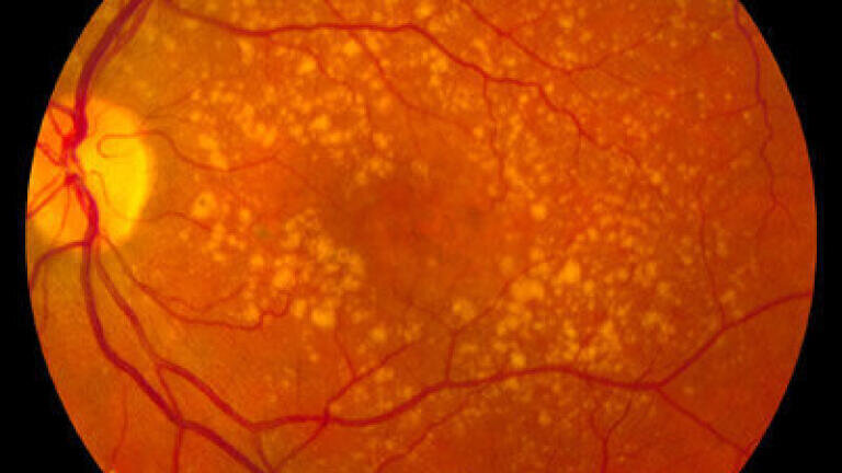 Preserving your Eyesight