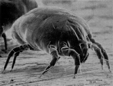 How to Find out Which Dust Mite Protein You're Allergic To

